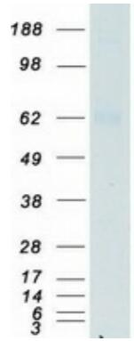 Coomassie blue staining of purified IFNGR1 protein.